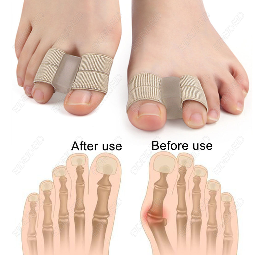 Korektor Jari Kaki Bunion Orto - Women'S Shoes With Bunions ulasan dan harga